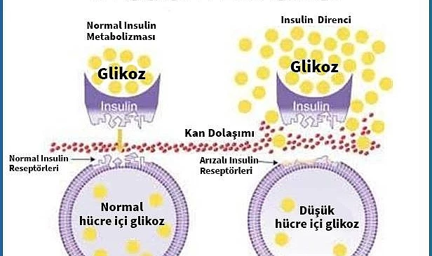 İNSÜLİN DİRENCİNİN 11 BELİRTİSİ   